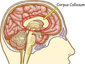 corpus callosum doorsnede menselijke hersenen